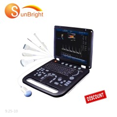 Vascular doppler  machine 3D laptop portable high resolution color ultrasound
