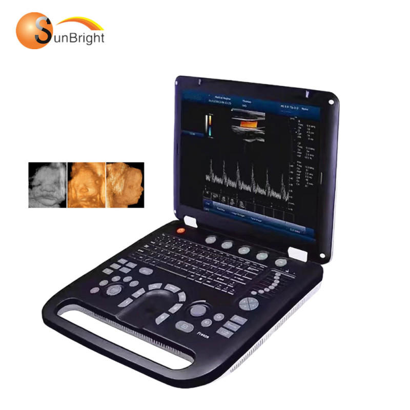 High quality medical echography laptop PC-based color doppler ultrasound machine SUN-906A