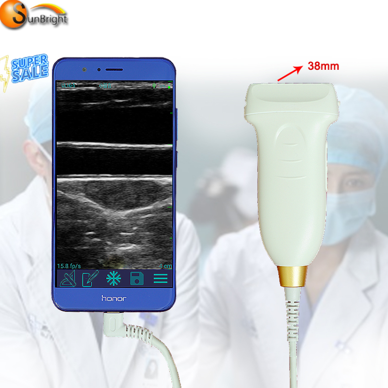 Factory price Portable ultrasound/USB wireless ultrasound probe bladder scan