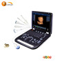 Medical equipment 4d laptop usg echo laptop ultrasound color doppler machine 3d baby ultrasound machine