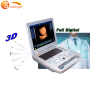 siemens echo machine SUN 800D simple system ultrasound