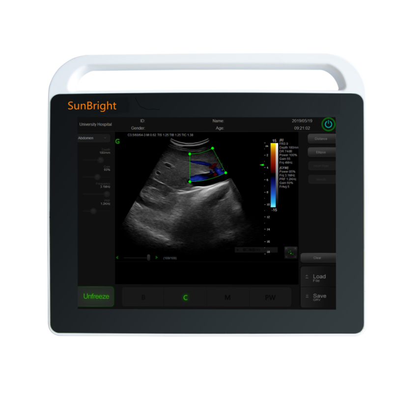 Medical high intensity portable handheld tablet hospital buy ultrasound machines SUN800S