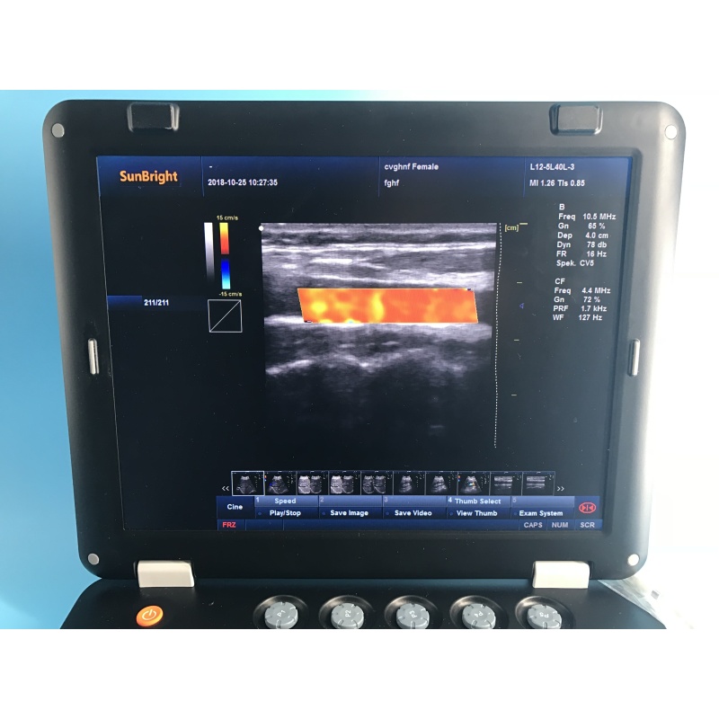 Factory price 3D 4D portable laptop ultrasound machine with convex probe