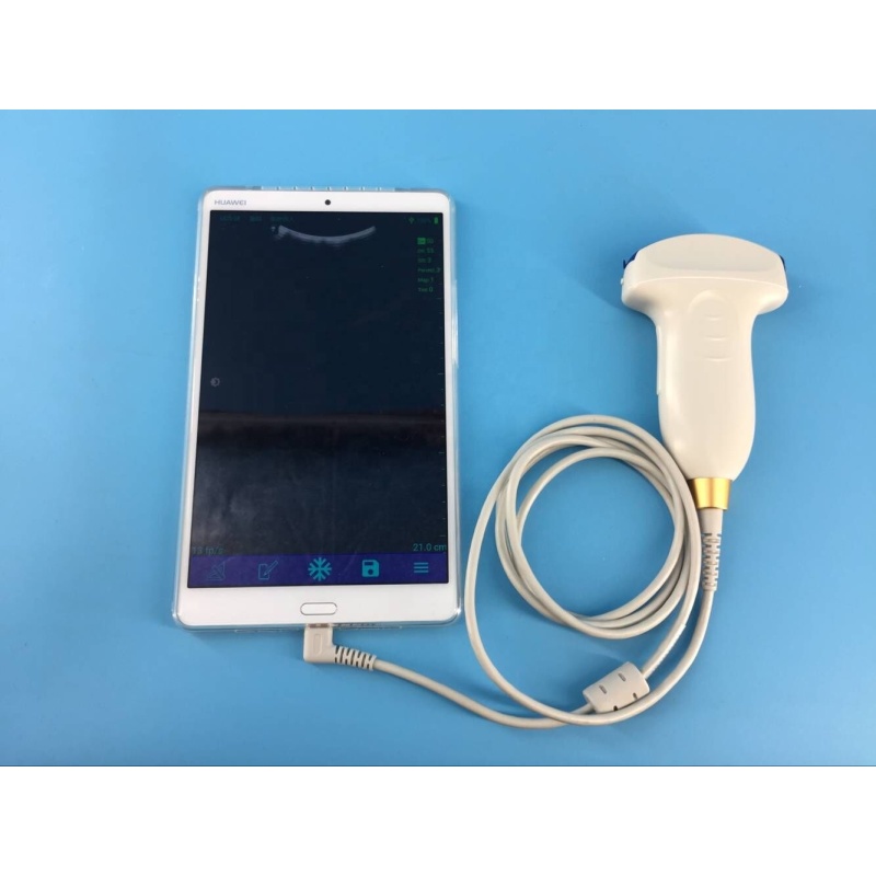 high end usb ultrasound convex probe usb usg transducer for laptop