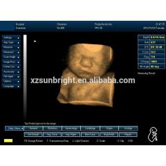 Veterinary animal pig pregnancy ultrasound scanner 3D medical ultrasound