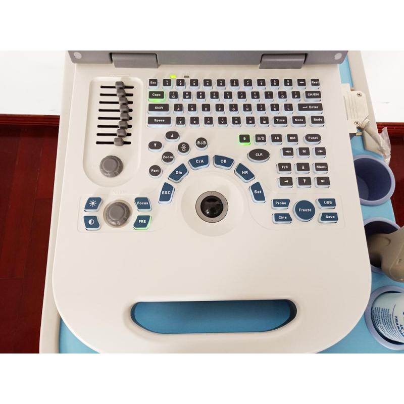 NUOVO ecografo color Doppler portatile economico in vendita