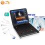 PW/CW 4D Color Doppler machine price prengnancy ultrasound color laptop doppler color