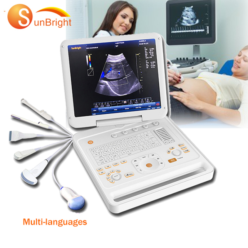 laptop 3D digit PW color Doppler medical system ultrasound device