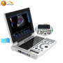Black and White 2D medical portable laptop ultrasound scanner machine price