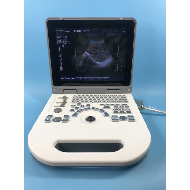 Portable machine color hospital pregnancy portable echocardiography machine