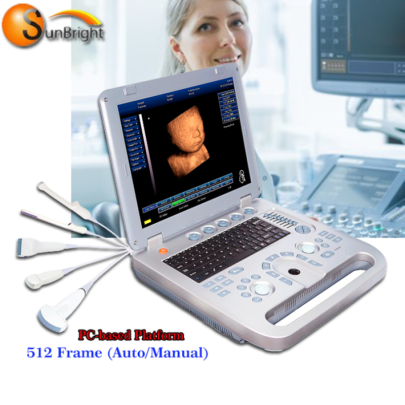 portable laptop ultrasound/laptop ultrasound scanner machine/laptop Ultrasound Scanner Convex