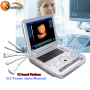 portable laptop ultrasound/laptop ultrasound scanner machine/laptop Ultrasound Scanner Convex