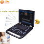 Laptop 128 elements 15 inch digital color doppler low cost ultrasound