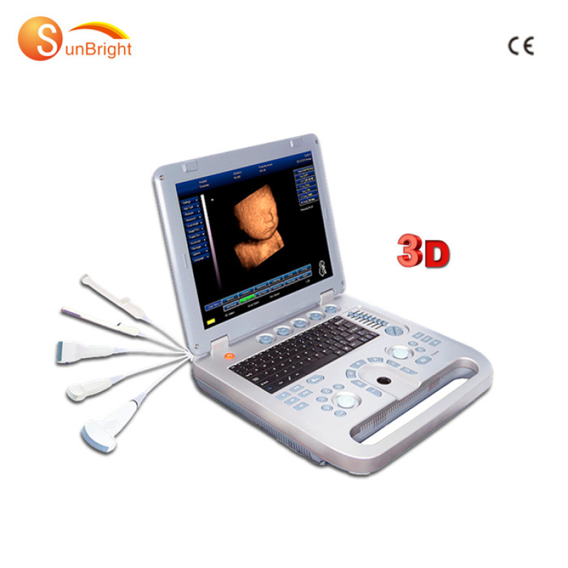 Hot sale SUN-800D CE Hospital Portable Black White ultrasound scanner Ultrasound machine Price