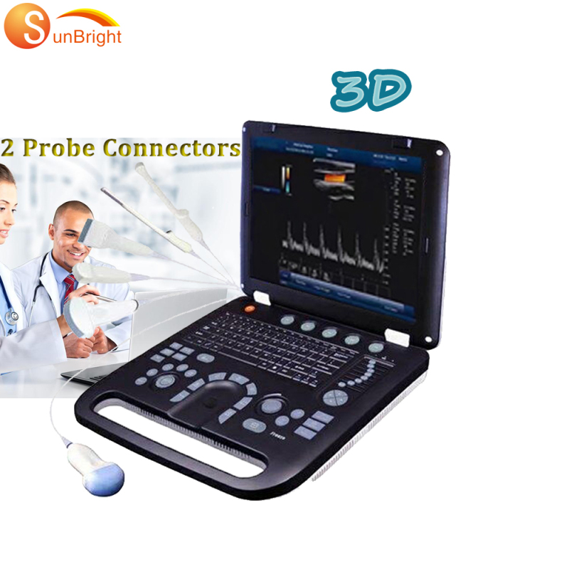 SUN-906A Допплер ультразвукова система ноутбук УЗД допплер ціна