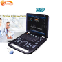 SUN-906A Допплер ультразвукова система ноутбук УЗД допплер ціна