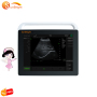 Human use ultrasound medical machine fetal ultrasound machine for home use