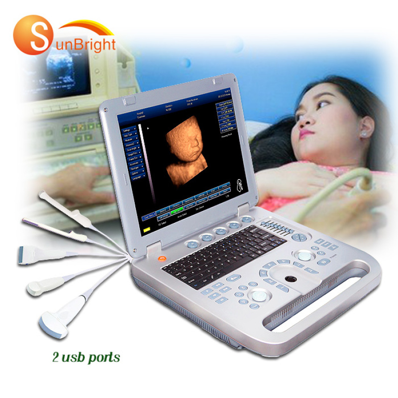 Medical full digital laptop vet 4d ultrasound machine mindray scanner machine with veterinary software