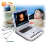 Medical full digital laptop vet 4d ultrasound machine mindray scanner machine with veterinary software