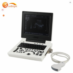 veterinary OB GYN diagnostic System ultrasound 2d portable ultrasound machine