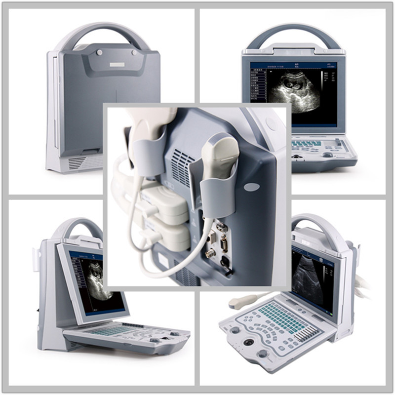Cheapest similar Mindray DP10 BW portable 2D ultrasound machine