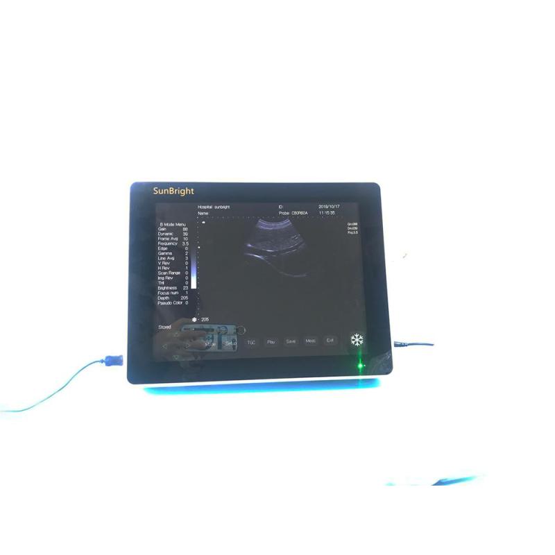 High Resolution LED 15 Inch Touch Screen Ultrasound Device Echocardiography potable ultrasound scanner Wireless