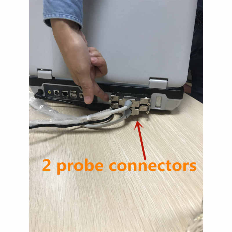 حار البائع جهاز الموجات فوق الصوتية 3D اللون دوبلر كمبيوتر محمول pw الطبية usg الماسح الضوئي