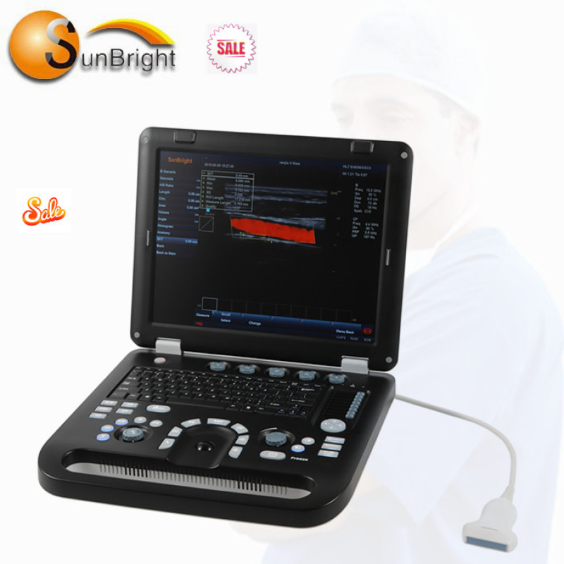Machine à ultrasons Doppler couleur 4D portable, meilleur vendeur, diagnostic