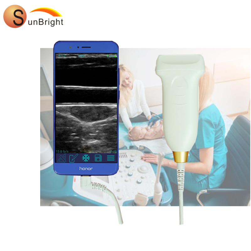 Portable 7.5Mhz USB linear probe ultrasound transducer best price USB ultrasound probe