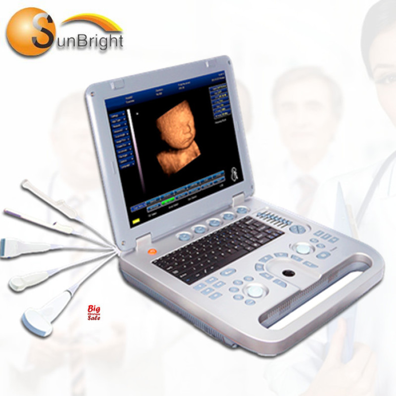 3D повний цифровий УЗД для домашнього використання Тест на вагітність Акушерське програмне забезпечення 3D УЗД