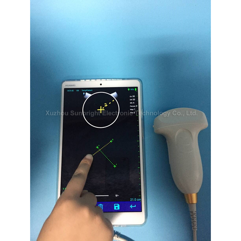 pw wireless phone use Ultrasound Scanner probe SUN-P1
