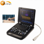 portable carry medical OB color doppler device home ultrasound machine scan