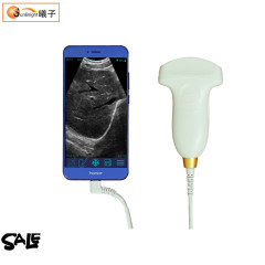 Wireless Ultrasound Probe Echographe Portable USB android ultrasound probe