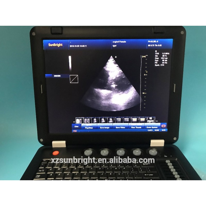 Sales 128 elements echography doppler ultrasound scan machine
