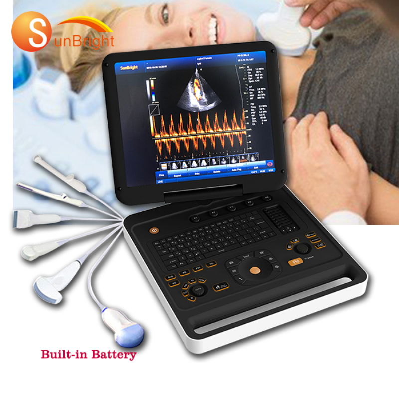 hot sale digital medical 3D 4D doppler ultrasound portable machine