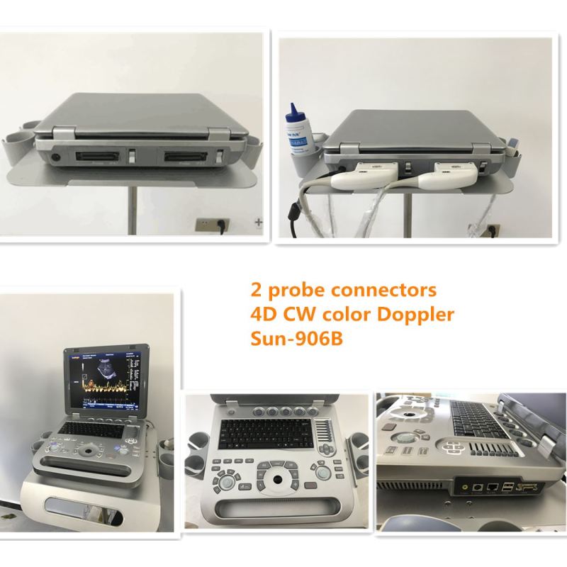 SUN-906A رخيصة كمبيوتر محمول محمول CW PW اللون الماسح الضوئي بالموجات فوق الصوتية دوبلر