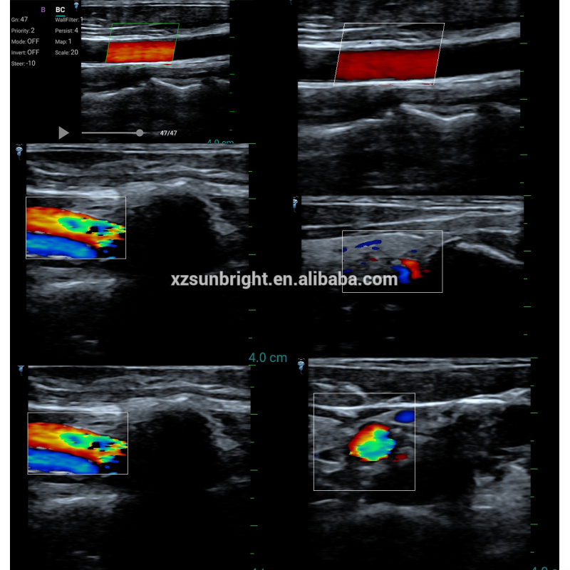 Portable linear probe ultrasound scanner color doppler ultrasound linear probe for iphone Andriod Ipad