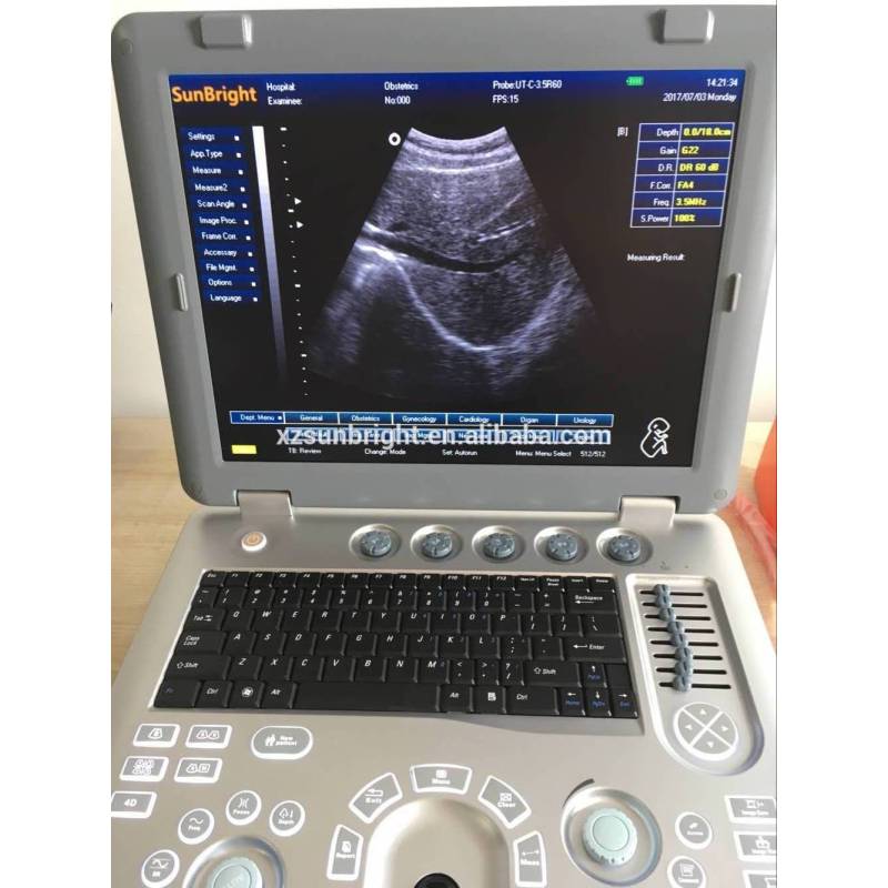 Histogram Sectional drawing Puncture guidance 3D portable ultrasound