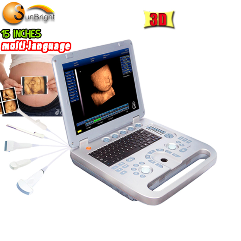 Black and white 15 inches ultrasound machine SUN-800D cheaper than mindray ultrasound