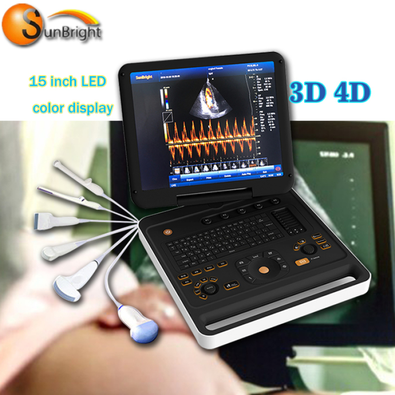 최고의 가격 노트북 컬러 도플러 초음파 기계 높은 비용 성능