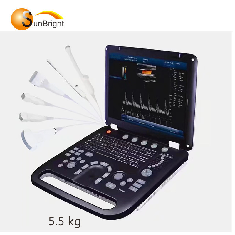 2019 nouvelle arrivée Scanner à ultrasons doppler couleur numérique pour la grossesse