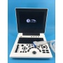 Portable LCD machine CE ultrasound scanner with top quality