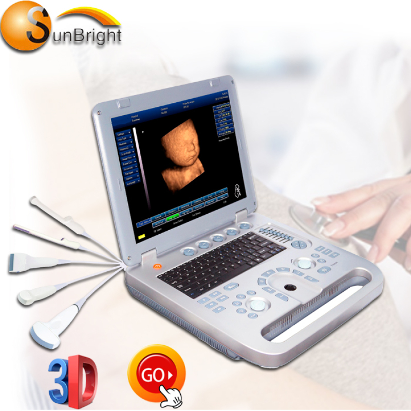 Hochwertiges, im Krankenhaus verwendetes mobiles 15-Zoll-Ultraschallgerät für die Schwangerschaft