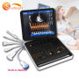 high intensity portable 4D medical echocardiography ultrasound machine