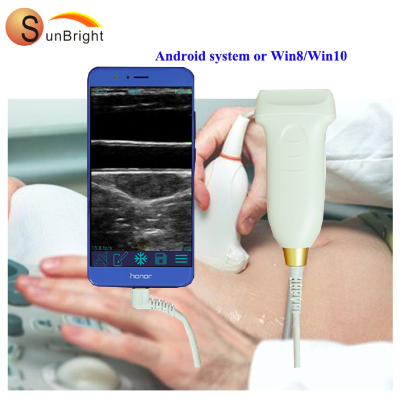핸들 초음파 스캐너 혈관 선형 프로브 USB 사용