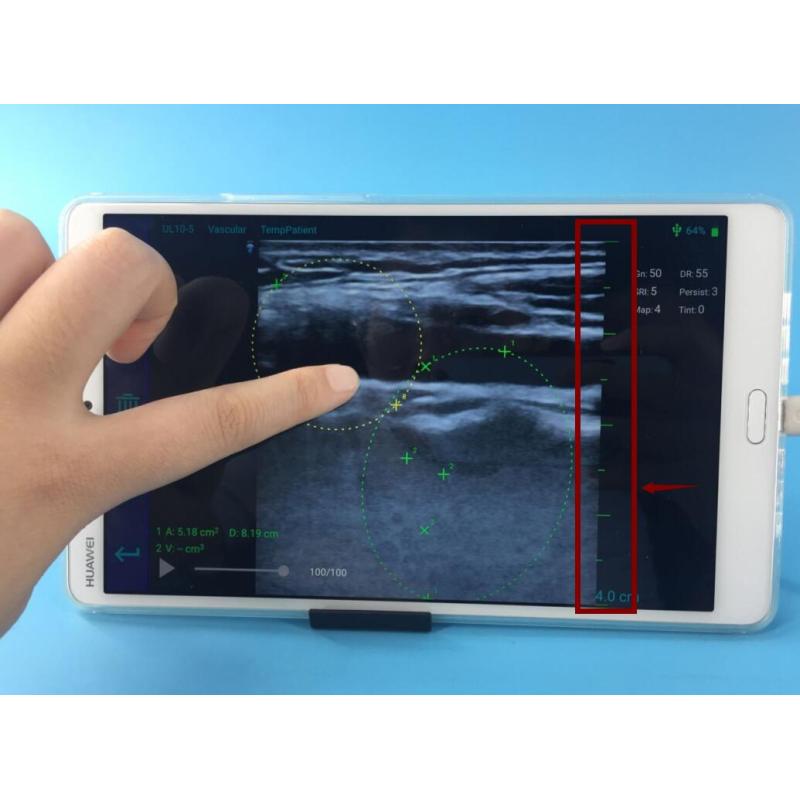 Sun-D3 Nueva sonda convexa caliente de 3.5 Mhz y sonda lineal de 7.5 Mhz sonda de ultrasonido doppler de color USB de doble cabeza