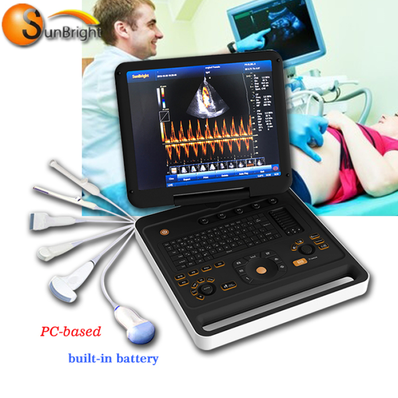 Nuovo arrivo per laptop 3D PW triplex duplex color Doppler USG machine SUN-906A
