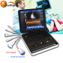 Nuovo arrivo per laptop 3D PW triplex duplex color Doppler USG machine SUN-906A