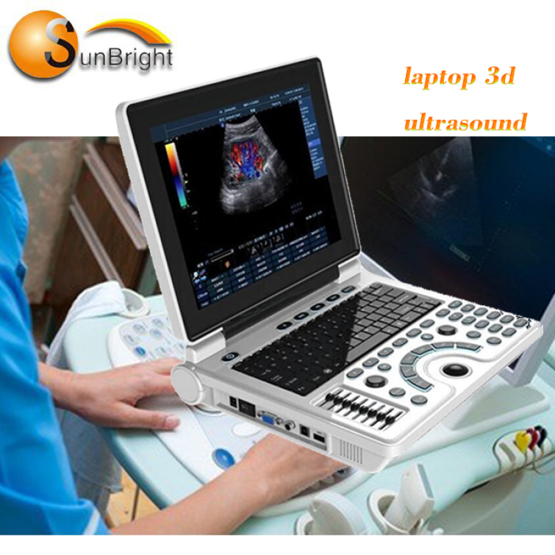 Sale medical laptop ultrasound B mode laptop ultrasound scanner