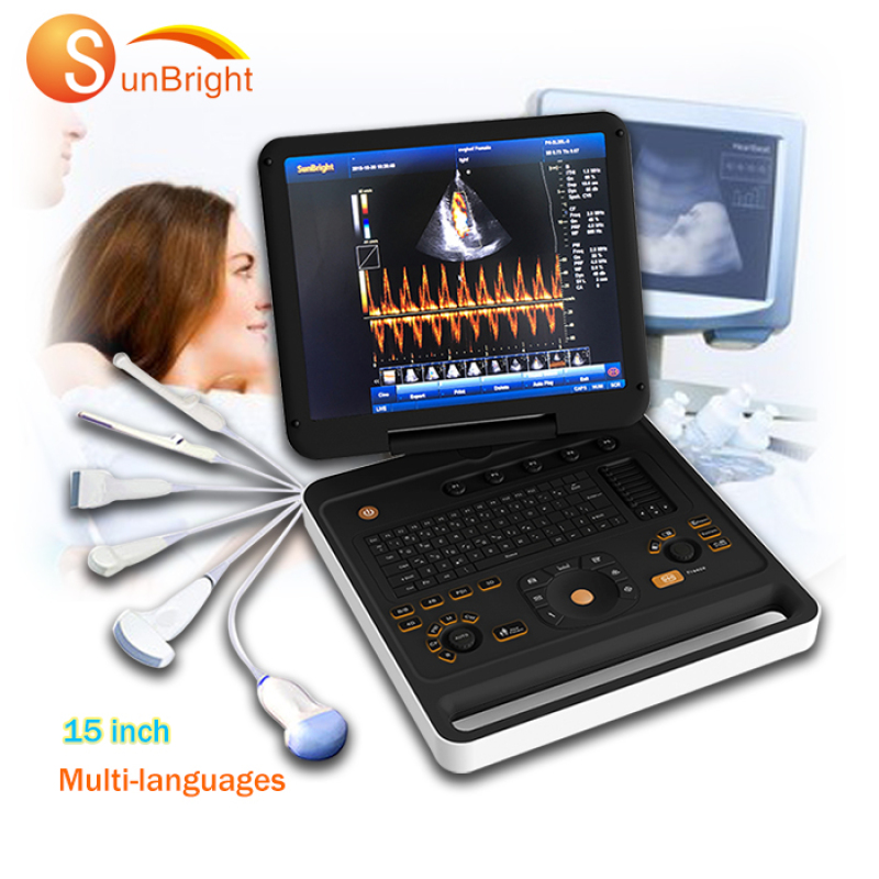 도플러 혈관 심장 기계 전체 디지털 에코 심장학 초음파 휴대용 스캐너